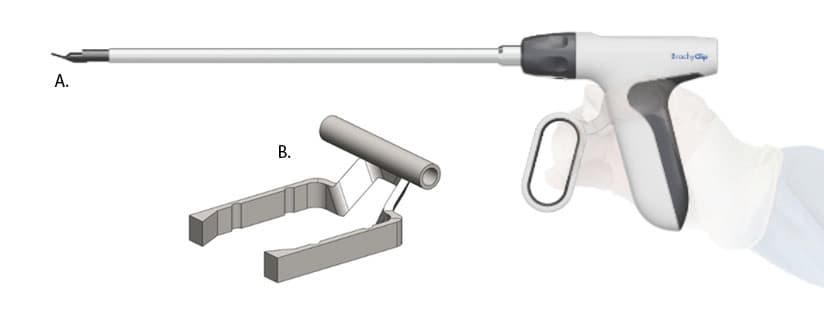 BrachyClip handheld applicator device with titanium clip detail