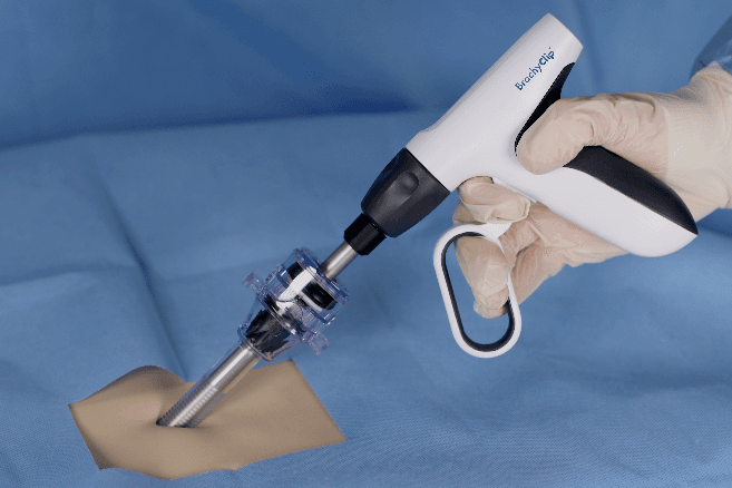 BrachyClip applier being inserted through laparoscopic trocar